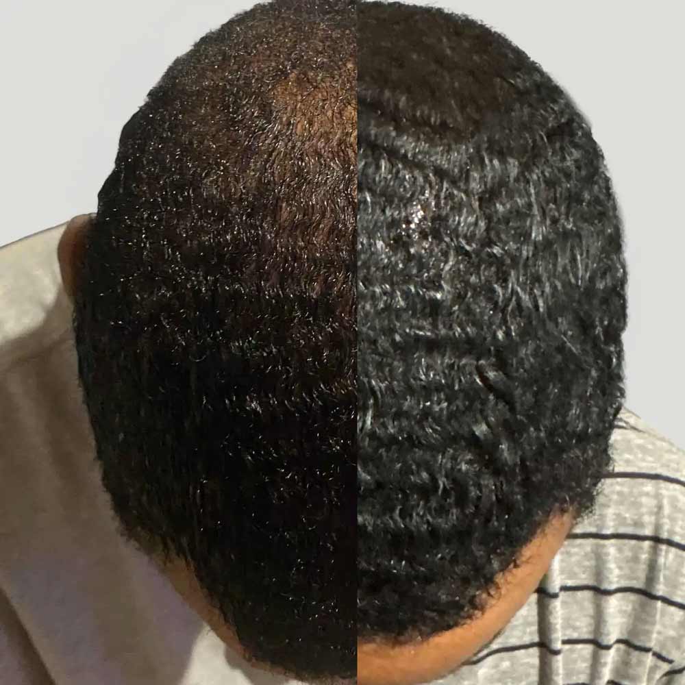MARO17 Fuller Hair Collagen Scalp Shot 2 Pack results